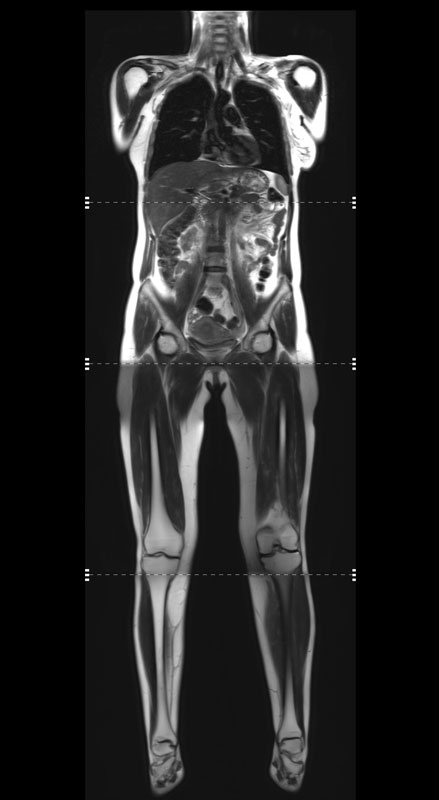 комплексное обследование Check-up