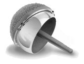 Birmingham Hip Resurfacing (BHR)